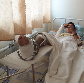 Специалисты ОДКБ спасли ногу ребенка от ампутации
